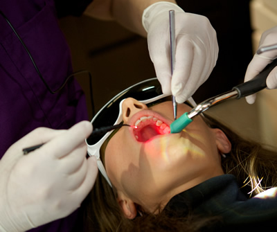 レーザー治療は、音と振動がなくその上痛みもない夢の歯科医療です