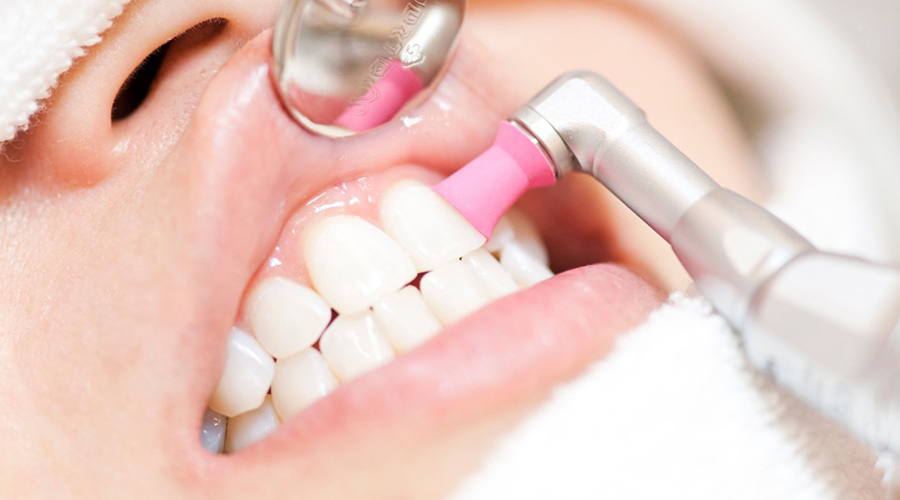 当院の提供する歯のクリーニングの特徴